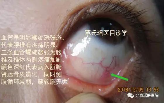 【历史沿革】瑶医基础理论概述